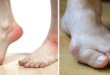 Кожата на краката ви говори повече за вашето здраве, отколкото си мислите – ето признаците, които трябва да търсите