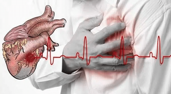 Сместта, която пази от инфаркт! Пие се 2 пъти в годината за здраво сърце и артерии